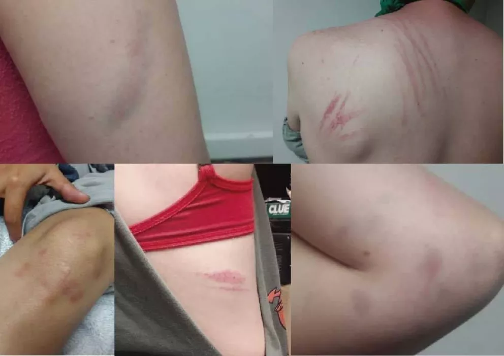 En la cuenta de Facebook, publicaron las fotos de las agresiones que sufrieron.