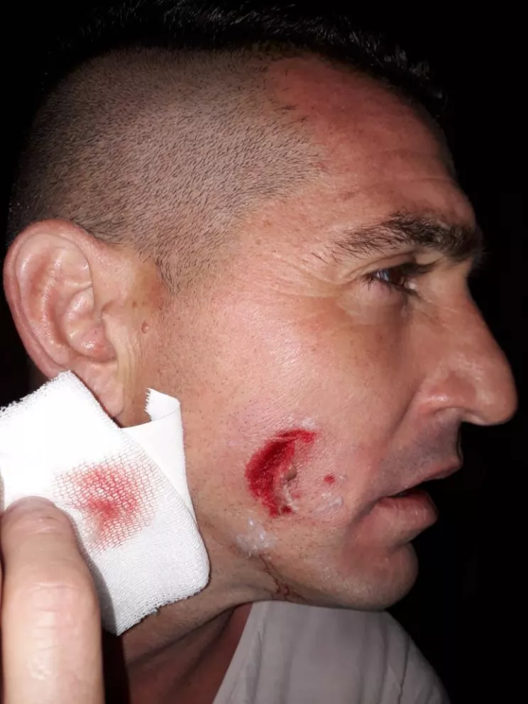 Rodrigo Manara sufrió un tremendo golpe en el rostro. Otro jugador del Depo se desmayó.