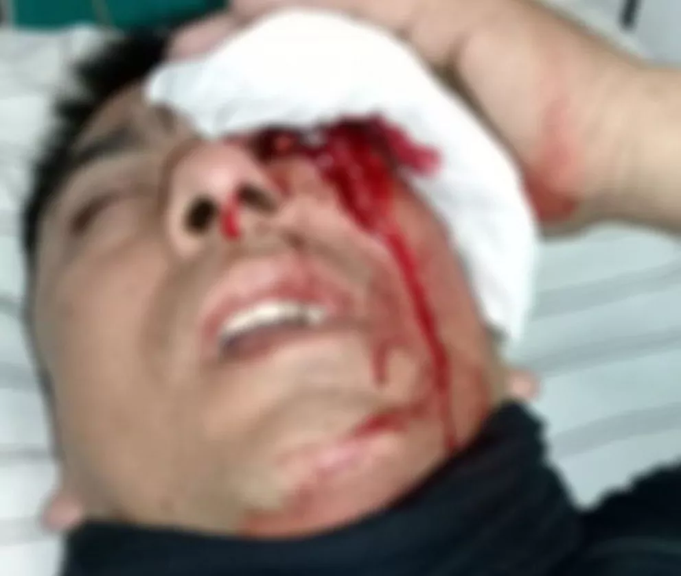 Agresión contra un policía: Formulan cargos a Báez, el violento referente de Odel