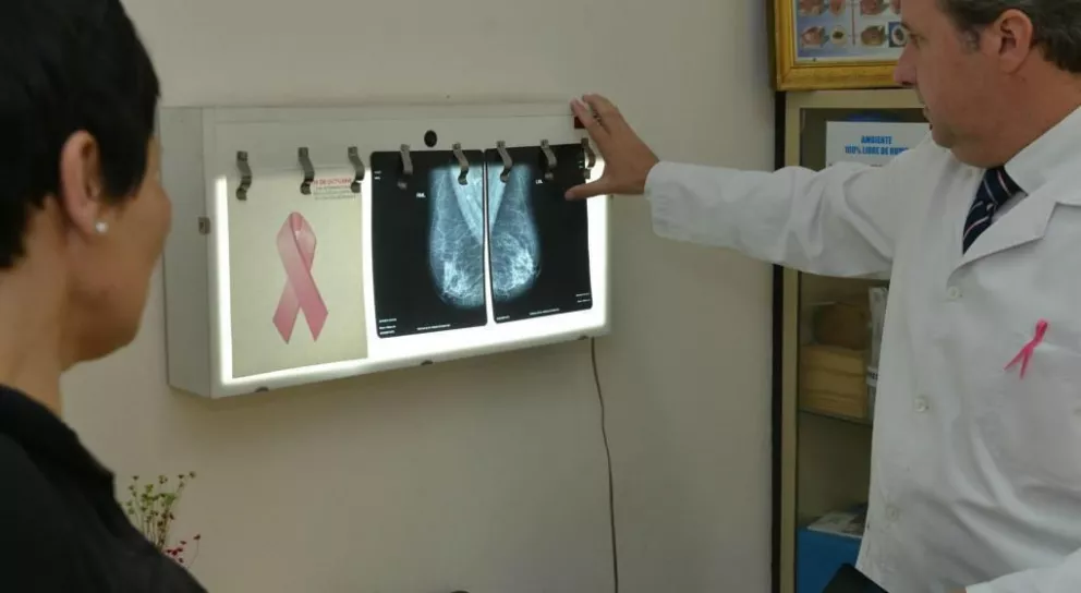 Mamografías gratuitas: inician campaña en Roca